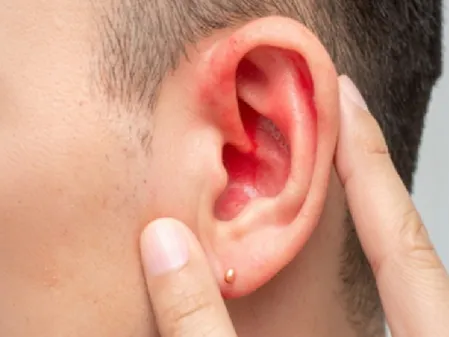 कान दर्द से राहत देगा अदरक-सेंधा नमक का तेल? जानें सही तरीका और जरूरी सावधानियां